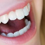 Dentista fala sobre importância da escovação regular