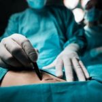 Quem fez cirurgia plástica precisa reforçar imunidade
