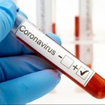 Região tem 224 casos de coronavírus